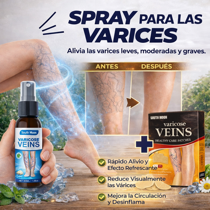 Tratamiento de venas varicosas VivaLegs™